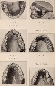 History of Orthodontics - Best Orthodontist NYC